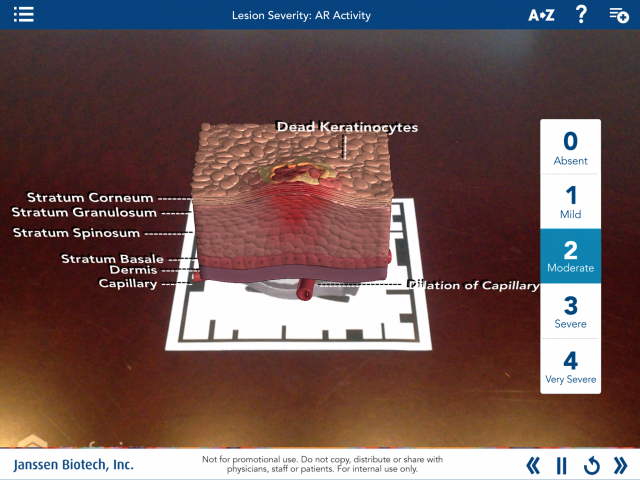 AR Example